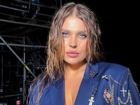 «Я хомяк»: Зарицкая показала себя с отеками после удаления зубов мудрости