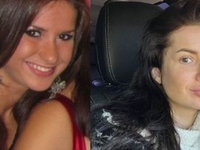 Шаманская призналась, сожалеет ли, что делала пластические операции