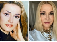 Сумская впервые призналась, почему удалила свою фирменную родинку на лице