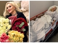 Бужинська перенесла операцію через серйозну травму ока