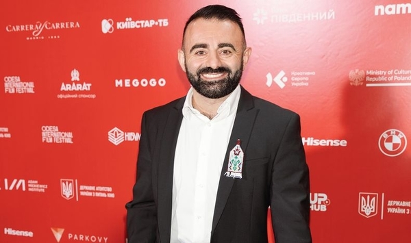 Звезда «Безумной свадьбы» Арам Арзуманян перенес операцию после травмы на сцене