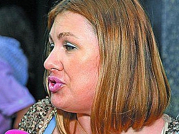 Новые силиконовые губы Евы Польны ( ФОТО )