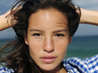 Кожа лица и веснушки