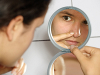 ТОП-7 неэффективных способов борьбы с угрями