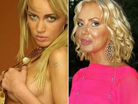 ТОП-10 звезд изуродованных пластическими операциями