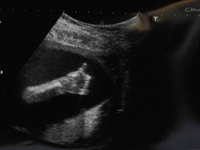 Курьезный случай на УЗИ