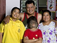 В Таиланде живет самая волосатая девочка в мире