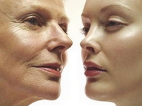 Новинка в косметологии: фракционное омоложение