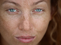 Как бороться с веснушками