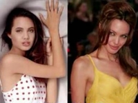 Звезды: До и после пластической операции