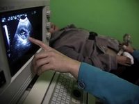 Ученые узнали, у каких женщин чаще возникают осложнения при беременности