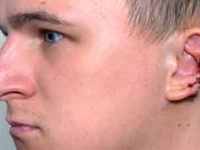 Звезде зарубежных глянцев в ходе драки откусили половину уха