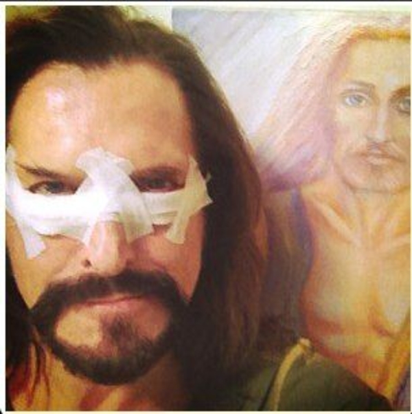 Никита Джигурда сделал пластическую операцию