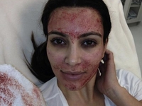 Ким Кардашян прошла кровавую процедуру в салоне красоты