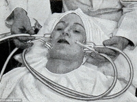 Жертвы красоты: Странные beauty-изобретения из прошлого