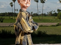 В теле старика: 14-летний мальчик из Индии выглядит на 110 лет