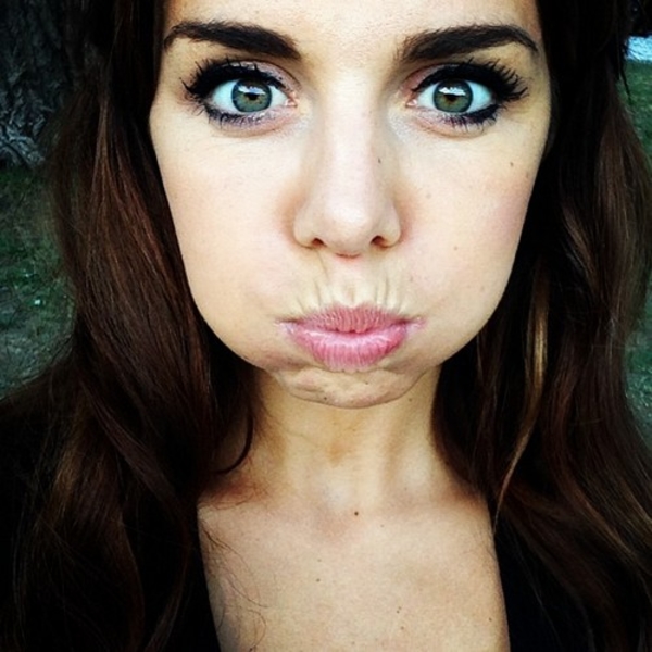 Анна Седокова часто страдает от похмелья