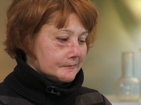 Я соромлюсь свого тіла: Врачи будут исправлять лицо героини после ДТП