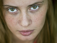 Как избавиться от веснушек