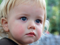 Ребенок перегрелся на солнце: Первая помощь