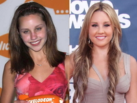 ТОП-10 звезд, которые открыто признались, что делали пластику