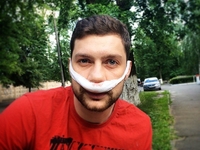 Финалист шоу Х-фактор Олег Кензов сделал пластику носа