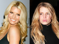 Нет пластике: Звезды, которые пожалели о своих пластических операциях