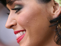 Звезды рассказали о том, как справляются с проблемой акне