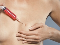 В Англии увеличивают грудь ботоксом: Звезды в восторге от новой процедуры