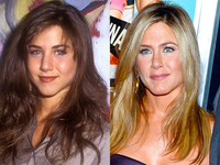 Звезды, которые делали ринопластику: Энистон, Диас и Ферги