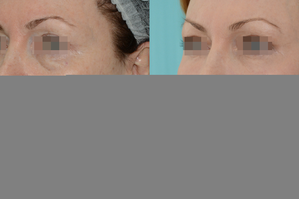 фото из архива