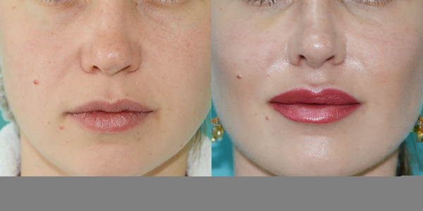 Хирург Павел Денищук: Современная косметология решает много проблем