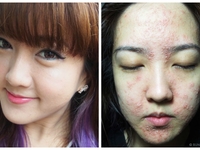 Берегись: 6 страшных историй про женские beauty-эксперименты