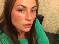 В Киеве избили телеведущую, пытавшуюся защитить девушку