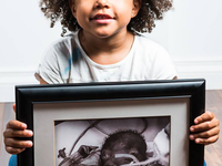 До и после: Снимки малышей, которые родились раньше срока