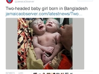В Бангладеше родилась малышка с двумя головами
