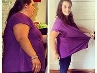 Откровенно о похудении: 24-летняя девушка показала личные фото