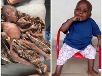 Шанс на нормальную жизнь: история спасения африканского малыша