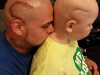 Отец сделал тату в виде шрама, чтобы поддержать сына