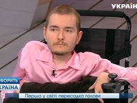 Первая в мире пересадка головы: эксклюзивные подробности операции