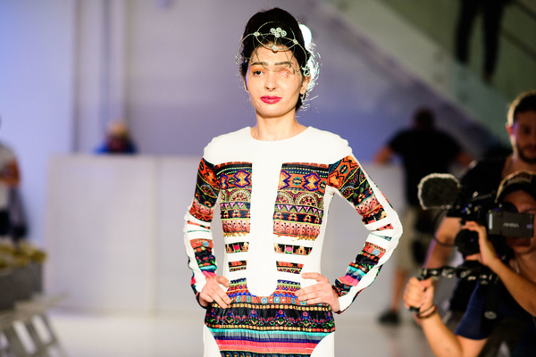 Девушка с обожженным кислотой лицом приняла участие в модном показе