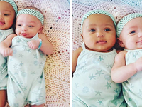 В штате США родились близнецы с разным цветом кожи