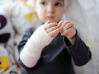 Что делать, если ребенок обжегся: советы доктора Комаровского