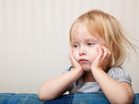 Как лечить ветрянку: советы доктора Комаровского