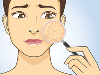 Как быстро убрать шелушения на коже: 5 проверенных способов