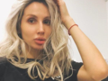 Светлана Лобода напугала поклонников ранами на теле