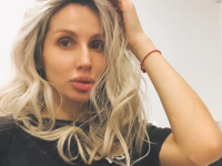 Светлана Лобода напугала поклонников ранами на теле