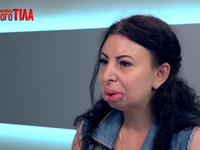 “Я соромлюсь свого тіла”: героиню с редким синдромом называют “жертвой пластики”