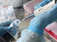 Где можно сделать тест на коронавирус в Киеве?