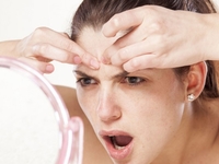 Прыщи на лбу: почему появляются высыпания?